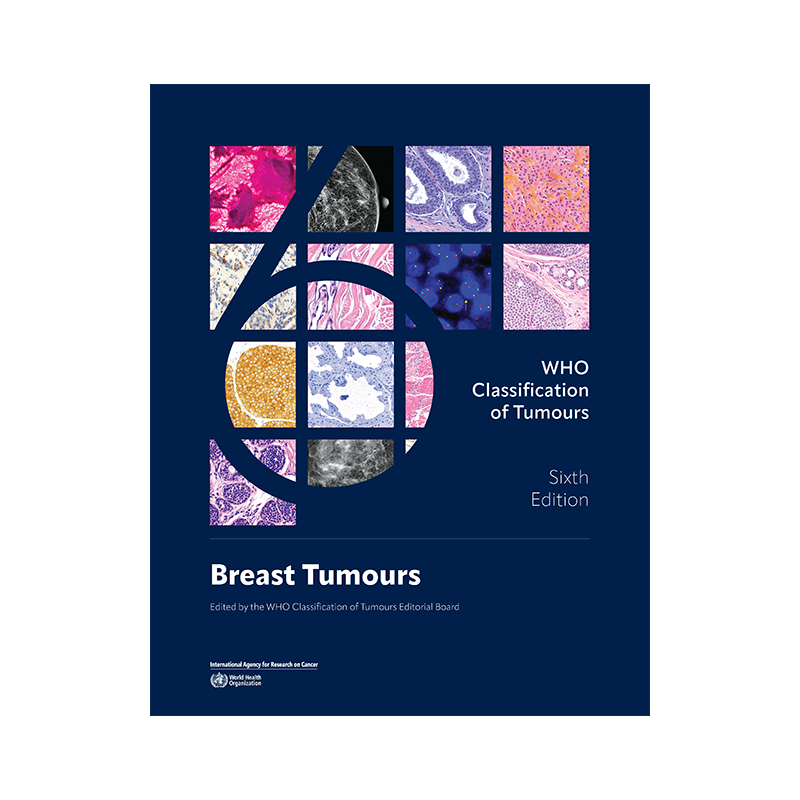 洋書 Breast Tumours , WHO 5th edition WHO Classification of Tumours Online