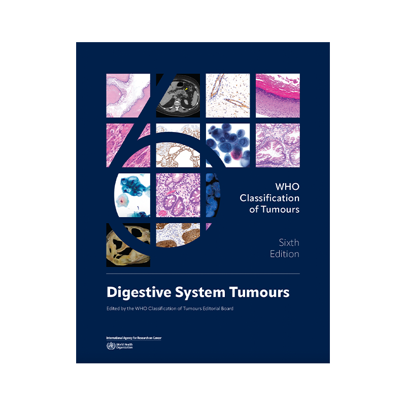 WHO Classification of Tumours Online